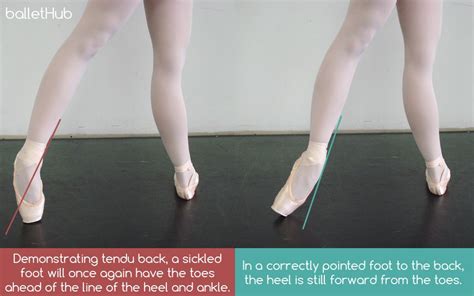 What Does Sickled Feet Mean in Dance: A Twist in the Tale of Grace